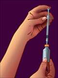 Insert Needle