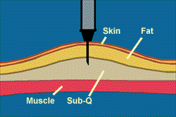 Skin Ilustration